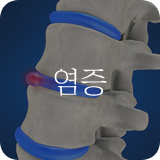염증