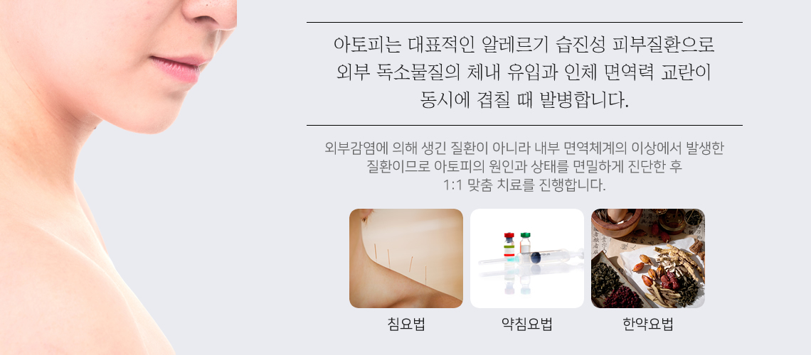 성인 아토피의 원인과 치료목표