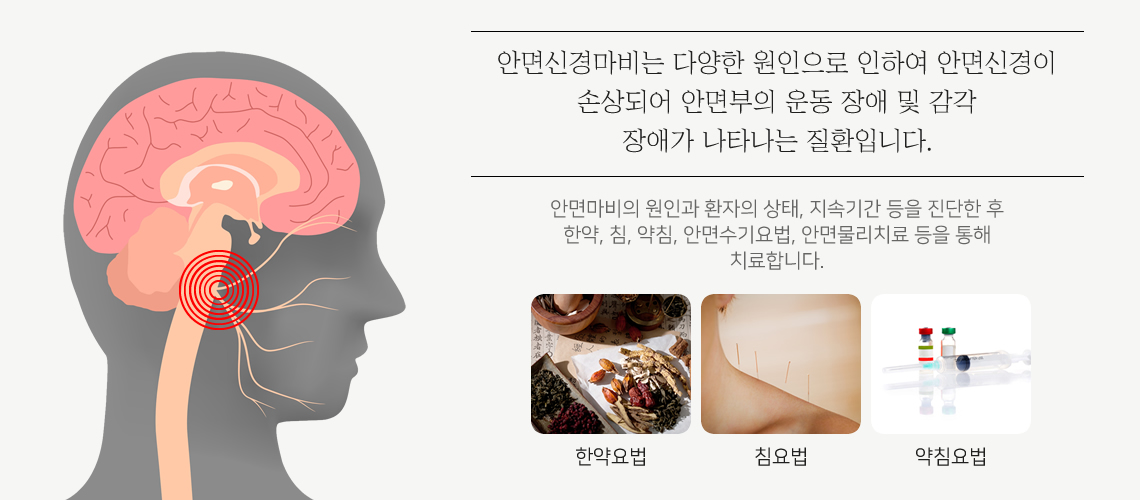안면마비 클리닉