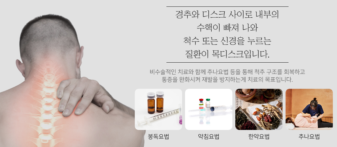 목디스크의 원인과 치료목표
