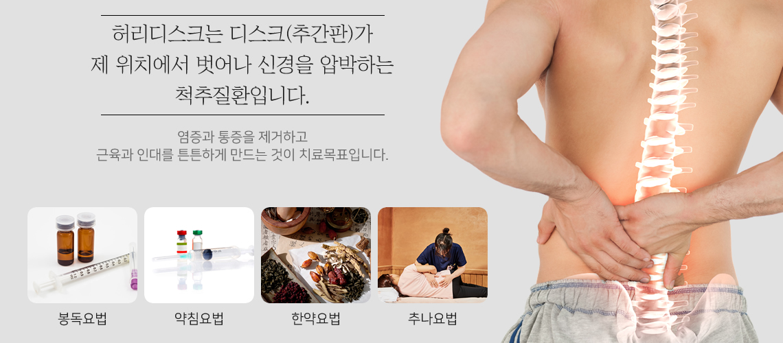 허리디스크 원인과 치료목표
